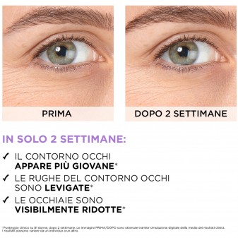 L'Oréal Paris Revitalift Siero Contorno Occhi Antirughe con Acido