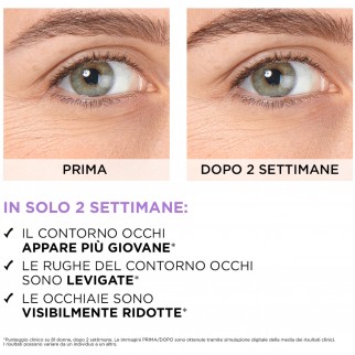L'Oréal Paris Revitalift Siero Contorno Occhi Antirughe con Acido