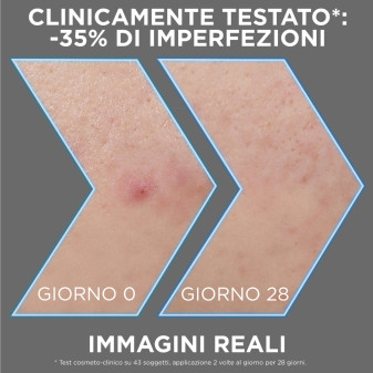 Siero Anti-Imperfezioni PureActive AHA BHA Carbone Garnier