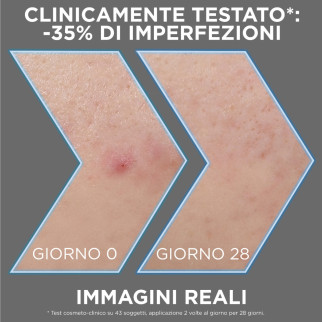 Siero Anti-Imperfezioni PureActive AHA BHA Carbone Garnier