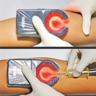 Rilevatore Vene Portatile Tecnologia di Illuminazione Trasversale Gima