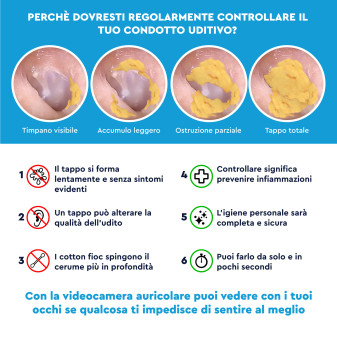 UdiGuard Otoscopio Pulizia Orecchie Rimozione Cerume Colore Nero