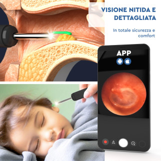 UdiGuard Otoscopio Pulizia Orecchie Rimozione Cerume Colore Nero